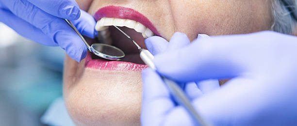 Best Emergency Dentist for Knocked-Out Tooth in Bruceton, TN